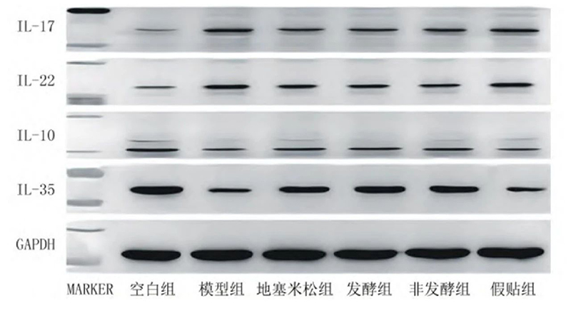 空白組和支氣管哮喘各組大鼠肺組織中IL－17、IL－22、IL－10、IL－35蛋白表達電泳圖